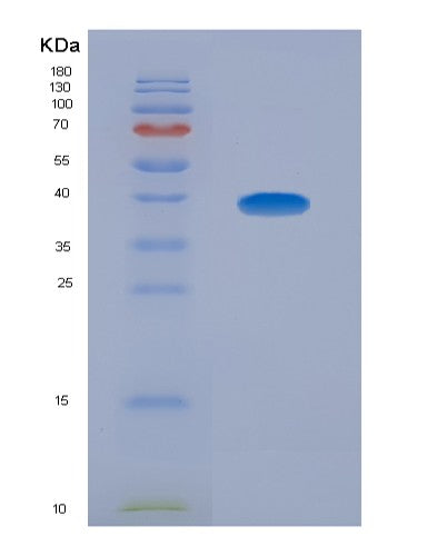 SDS-PAGE analysis of Human SLAMF1 (Signaling Lymphocytic Activation Molecule) - Recombinant Protein, showing >90% purity under 15% SDS-PAGE (Reduced)