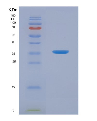 SDS-PAGE analysis of Human COX4I1 (Cytochrome C Oxidase Subunit 4 Isoform 1, Mitochondrial) - Recombinant Protein, showing >90% purity under 15% SDS-PAGE (Reduced)