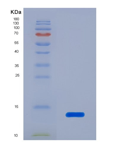 SDS-PAGE analysis of Human LAMTOR5 (Ragulator Complex Protein Lamtor5) - Recombinant Protein, showing >85% purity under 15% SDS-PAGE (Reduced)