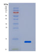 SDS-PAGE analysis of Human LAMTOR5 (Ragulator Complex Protein Lamtor5) - Recombinant Protein, showing >85% purity under 15% SDS-PAGE (Reduced)