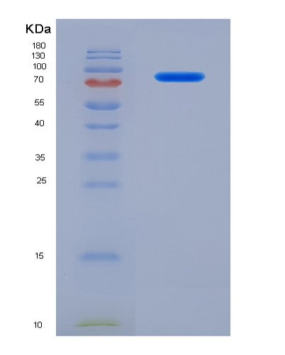 SDS-PAGE analysis of Human SERPING1 (Plasma Protease C1 Inhibitor) - Recombinant Protein, showing >95% purity under 15% SDS-PAGE (Reduced)