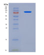 SDS-PAGE analysis of Human SERPING1 (Plasma Protease C1 Inhibitor) - Recombinant Protein, showing >95% purity under 15% SDS-PAGE (Reduced)