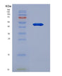SDS-PAGE analysis of Human DSG3 (Desmoglein-3) - Recombinant Protein, showing >90% purity under 15% SDS-PAGE (Reduced)