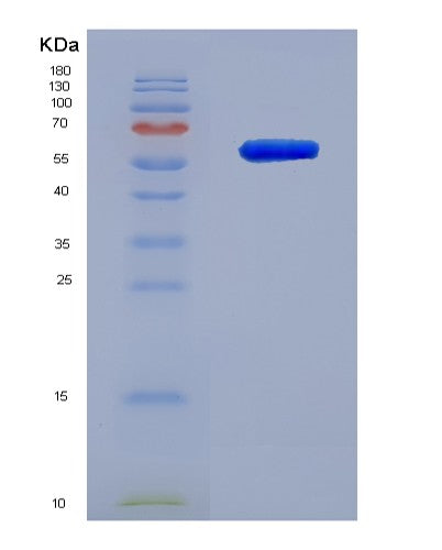 SDS-PAGE analysis of Human DSG1 (Desmoglein-1) - Recombinant Protein, showing >90% purity under 15% SDS-PAGE (Reduced)