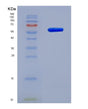SDS-PAGE analysis of Human DSG1 (Desmoglein-1) - Recombinant Protein, showing >90% purity under 15% SDS-PAGE (Reduced)
