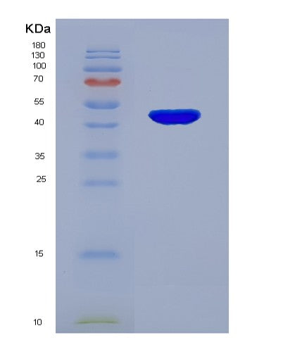 SDS-PAGE analysis of Human IL12B (Interleukin-12 Subunit Beta) - Recombinant Protein, showing >90% purity under 15% SDS-PAGE (Reduced)