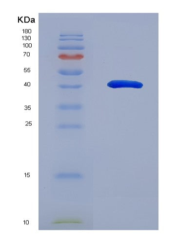 SDS-PAGE analysis of Human PRMT1 (Protein Arginine N-Methyltransferase 1) - Recombinant Protein, showing >90% purity under 15% SDS-PAGE (Reduced)