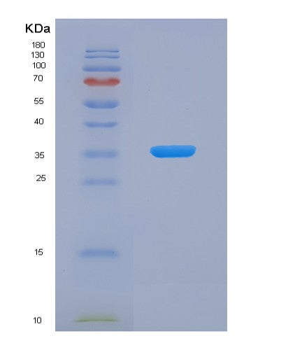 SDS-PAGE analysis of Human FHL1 (Four And A Half Lim Domains Protein 1) - Recombinant Protein, showing >90% purity under 15% SDS-PAGE (Reduced)