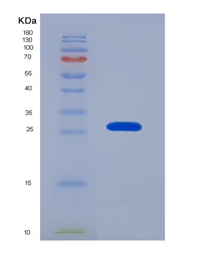SDS-PAGE analysis of Mouse Prtn3 (Myeloblastin) - Recombinant Protein, showing >90% purity under 15% SDS-PAGE (Reduced)