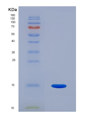 SDS-PAGE analysis of Human PGF (Placenta Growth Factor) - Recombinant Protein, showing >90% purity under 15% SDS-PAGE (Reduced)