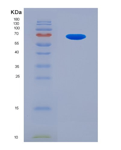 SDS-PAGE analysis of Human RSPO3 (R-Spondin-3) - Recombinant Protein, showing >90% purity under 15% SDS-PAGE (Reduced)