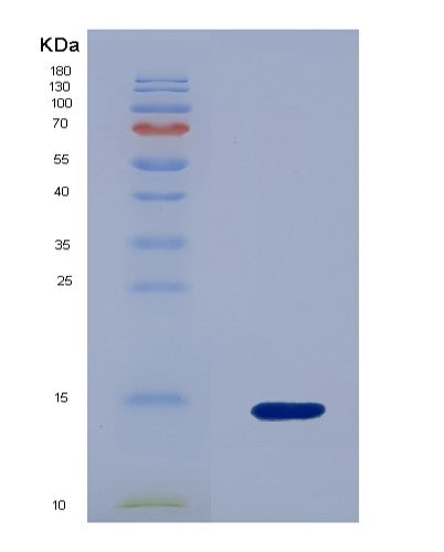 SDS-PAGE analysis of Human NR3C1 (Glucocorticoid Receptor) - Recombinant Protein, showing >90% purity under 15% SDS-PAGE (Reduced)