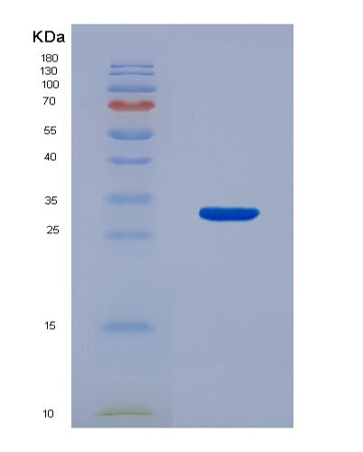 SDS-PAGE analysis of Mouse Ccn3 (Ccn Family Member 3) - Recombinant Protein, showing >90% purity under 15% SDS-PAGE (Reduced)