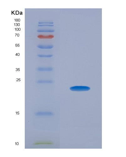 SDS-PAGE analysis of Mouse Apob (Apolipoprotein B-100) - Recombinant Protein, showing >90% purity under 15% SDS-PAGE (Reduced)