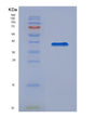 SDS-PAGE analysis of Mouse Mmp8 (Neutrophil Collagenase) - Recombinant Protein, showing >90% purity under 15% SDS-PAGE (Reduced)