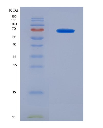 SDS-PAGE analysis of Mouse Il15ra (Interleukin-15 Receptor Subunit Alpha) - Recombinant Protein, showing >90% purity under 15% SDS-PAGE (Reduced)