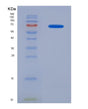 SDS-PAGE analysis of Mouse Il15ra (Interleukin-15 Receptor Subunit Alpha) - Recombinant Protein, showing >90% purity under 15% SDS-PAGE (Reduced)