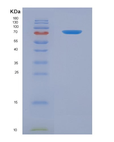 SDS-PAGE analysis of Mouse Gas6 (Growth Arrest-Specific Protein 6) - Recombinant Protein, showing >90% purity under 15% SDS-PAGE (Reduced)