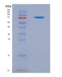 SDS-PAGE analysis of Mouse Gas6 (Growth Arrest-Specific Protein 6) - Recombinant Protein, showing >90% purity under 15% SDS-PAGE (Reduced)