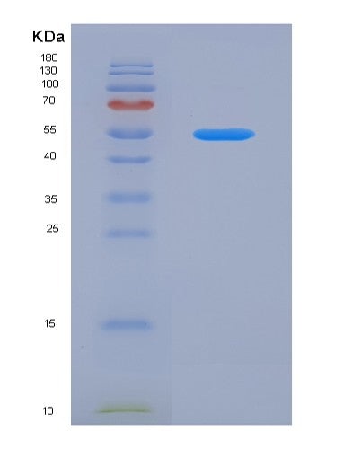 SDS-PAGE analysis of Human TNFRSF14 (Tumor Necrosis Factor Receptor Superfamily Member 14) - Recombinant Protein, showing >95% purity under 15% SDS-PAGE (Reduced)