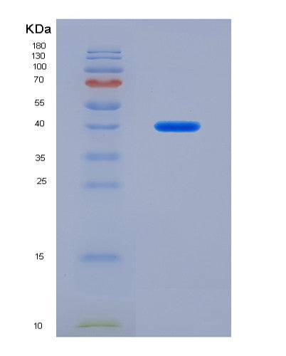 SDS-PAGE analysis of Human IL21R (Interleukin-21 Receptor) - Recombinant Protein, showing >90% purity under 15% SDS-PAGE (Reduced)