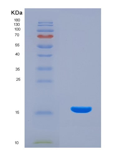SDS-PAGE analysis of Human DGAT2 (Diacylglycerol O-Acyltransferase 2) - Recombinant Protein, showing >90% purity under 15% SDS-PAGE (Reduced)