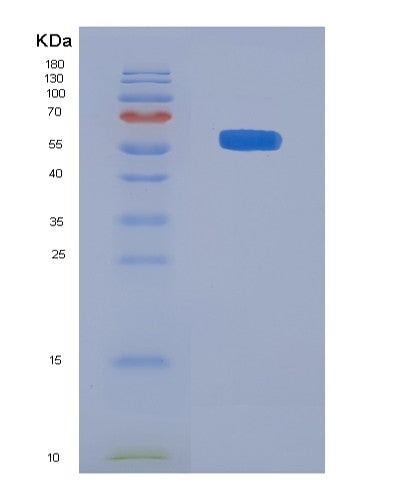SDS-PAGE analysis of Human F10 (Coagulation Factor X) - Recombinant Protein, showing >90% purity under 15% SDS-PAGE (Reduced)