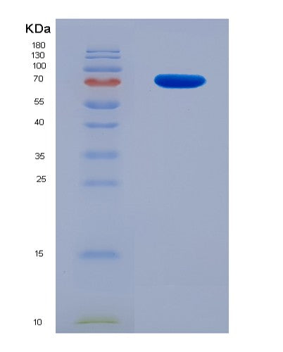 SDS-PAGE analysis of Human GRIN2B (Glutamate Receptor Ionotropic, Nmda 2B) - Recombinant Protein, showing >90% purity under 15% SDS-PAGE (Reduced)