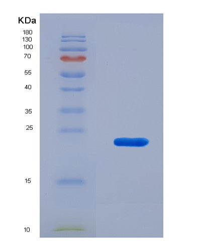 SDS-PAGE analysis of Human ITGA2B (Integrin Alpha-Iib) - Recombinant Protein, showing >90% purity under 15% SDS-PAGE (Reduced)