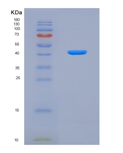 SDS-PAGE analysis of Mouse Ctsb (Cathepsin B) - Recombinant Protein, showing >85% purity under 15% SDS-PAGE (Reduced)