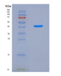 SDS-PAGE analysis of Mouse Ctsb (Cathepsin B) - Recombinant Protein, showing >85% purity under 15% SDS-PAGE (Reduced)