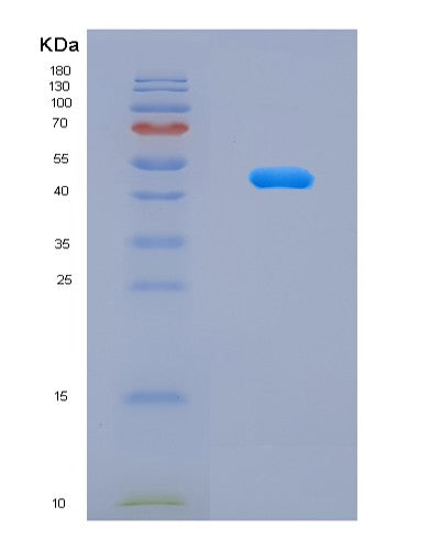 SDS-PAGE analysis of Human NCR3LG1 (Natural Cytotoxicity Triggering Receptor 3 Ligand 1) - Recombinant Protein, showing >95% purity under 15% SDS-PAGE (Reduced)