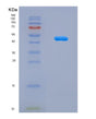 SDS-PAGE analysis of Human NCR3LG1 (Natural Cytotoxicity Triggering Receptor 3 Ligand 1) - Recombinant Protein, showing >95% purity under 15% SDS-PAGE (Reduced)