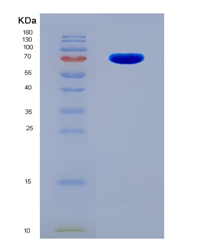 SDS-PAGE analysis of Human CRTAM (Cytotoxic And Regulatory T-Cell Molecule) - Recombinant Protein, showing >95% purity under 15% SDS-PAGE (Reduced)