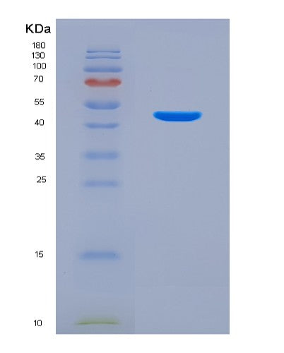 SDS-PAGE analysis of Mouse Il12b (Interleukin-12 Subunit Beta) - Recombinant Protein, showing >95% purity under 15% SDS-PAGE (Reduced)