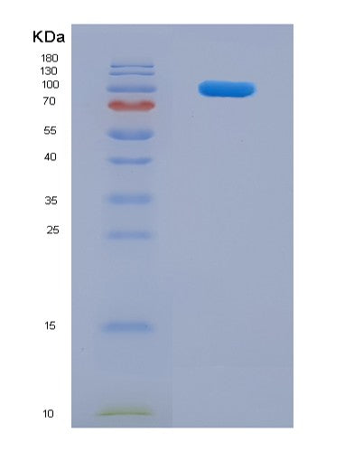 SDS-PAGE analysis of Mouse Cd36 (Platelet Glycoprotein 4) - Recombinant Protein, showing >85% purity under 15% SDS-PAGE (Reduced)