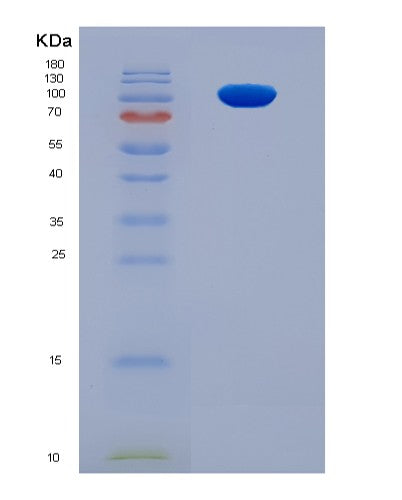 SDS-PAGE analysis of Mouse Erbb3 (Receptor Tyrosine-Protein Kinase Erbb-3) - Recombinant Protein, showing >95% purity under 15% SDS-PAGE (Reduced)