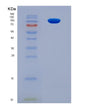 SDS-PAGE analysis of Mouse Erbb3 (Receptor Tyrosine-Protein Kinase Erbb-3) - Recombinant Protein, showing >95% purity under 15% SDS-PAGE (Reduced)