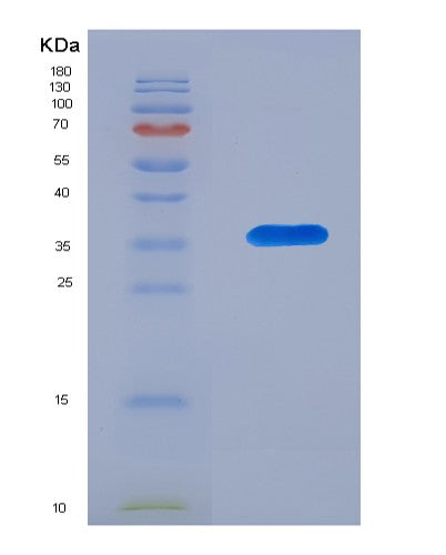 SDS-PAGE analysis of Human CD52 (Campath-1 Antigen) - Recombinant Protein, showing >90% purity under 15% SDS-PAGE (Reduced)