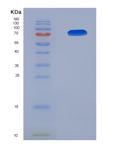 SDS-PAGE analysis of Human AMIGO2 (Amphoterin-Induced Protein 2) - Recombinant Protein, showing >85% purity under 15% SDS-PAGE (Reduced)