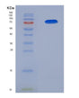 SDS-PAGE analysis of Human AMIGO2 (Amphoterin-Induced Protein 2) - Recombinant Protein, showing >85% purity under 15% SDS-PAGE (Reduced)
