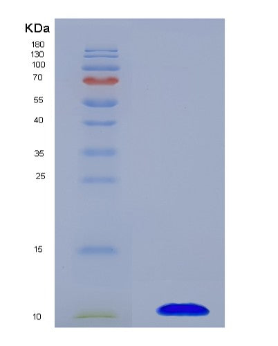SDS-PAGE analysis of Human SLC22A12 (Solute Carrier Family 22 Member 12) - Recombinant Protein, showing >90% purity under 15% SDS-PAGE (Reduced)