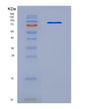 SDS-PAGE analysis of Mouse Icam1 (Intercellular Adhesion Molecule 1) - Recombinant Protein, showing >95% purity under 15% SDS-PAGE (Reduced)