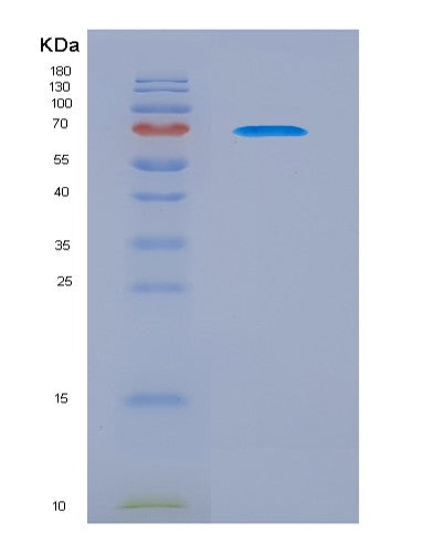 SDS-PAGE analysis of Human CADM1 (Cell Adhesion Molecule 1) - Recombinant Protein, showing >90% purity under 15% SDS-PAGE (Reduced)