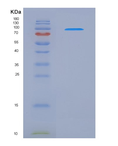 SDS-PAGE analysis of Mouse Nrp1 (Neuropilin-1) - Recombinant Protein, showing >90% purity under 15% SDS-PAGE (Reduced)