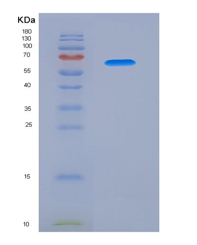 SDS-PAGE analysis of Human PSG1 (Pregnancy-Specific Beta-1-Glycoprotein 1) - Recombinant Protein, showing >95% purity under 15% SDS-PAGE (Reduced)