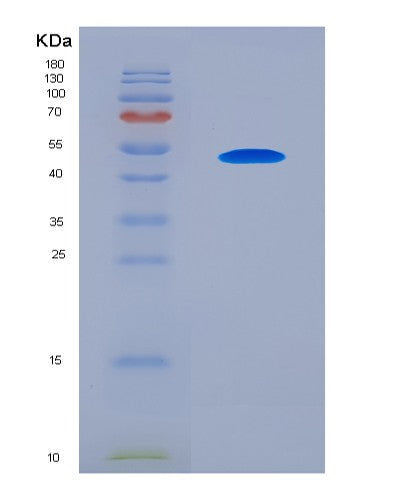 SDS-PAGE analysis of Human SERPINA12 (Serpin A12) - Recombinant Protein, showing >85% purity under 15% SDS-PAGE (Reduced)