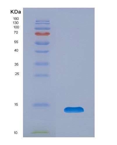 SDS-PAGE analysis of Human TFF1 (Trefoil Factor 1) - Recombinant Protein, showing >90% purity under 15% SDS-PAGE (Reduced)