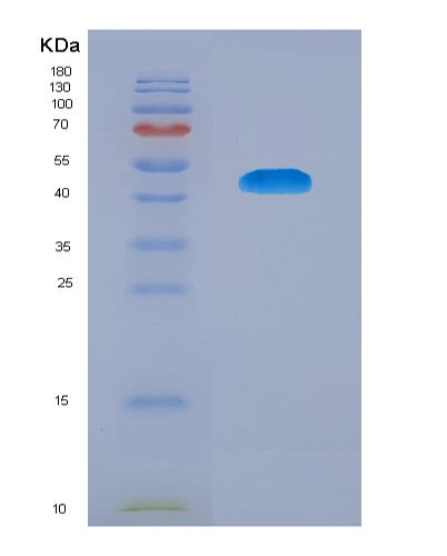 SDS-PAGE analysis of Human TSHR (Thyrotropin Receptor) - Recombinant Protein, showing >90% purity under 15% SDS-PAGE (Reduced)
