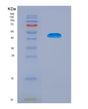 SDS-PAGE analysis of Human TSHR (Thyrotropin Receptor) - Recombinant Protein, showing >90% purity under 15% SDS-PAGE (Reduced)